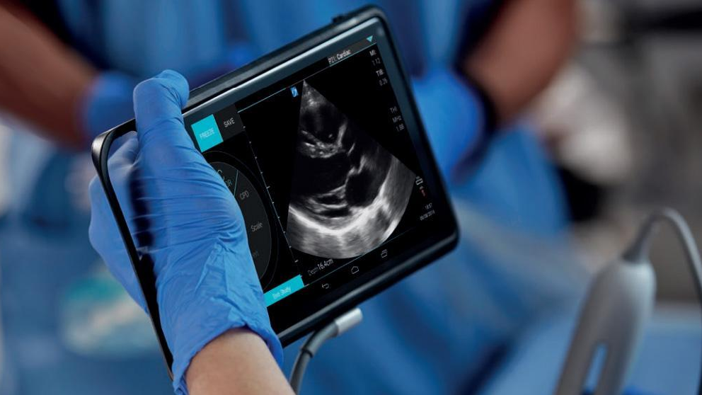 Gloved clinician holding a Sonosite iViz tablet displaying an ultrasound scan